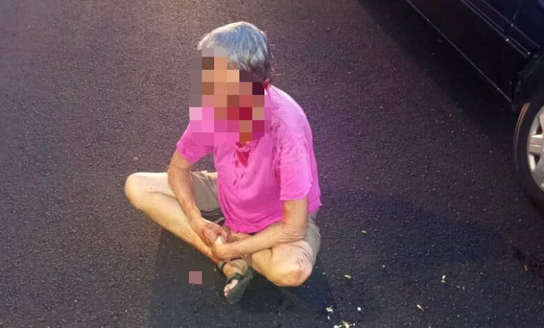 Warga emas alami pendarahan kepala akibat disamun