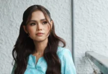 Bella Astillah Akui Bakal Pakai Braces