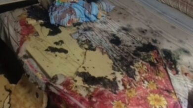 Isteri simbah asid pada suami semasa hari jadi