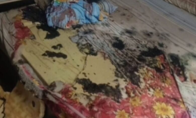 Isteri simbah asid pada suami semasa hari jadi