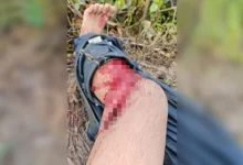 Banjir: Lelaki cedera parah dibaham buaya