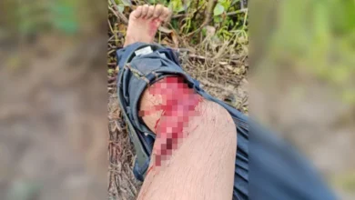 Banjir: Lelaki cedera parah dibaham buaya