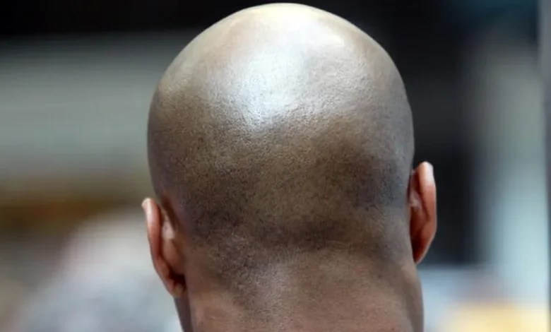 Wanita buat laporan polis, tak suka suami botak