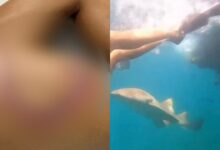 Paha wanita carik dibaham jerung