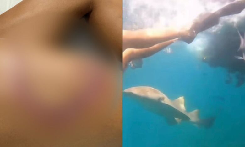 Paha wanita carik dibaham jerung