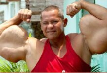 ‘Popeye’ Brazil miliki lengan terbesar meninggal dunia