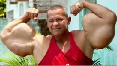 ‘Popeye’ Brazil miliki lengan terbesar meninggal dunia
