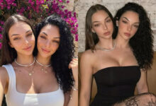 Valeria, Camila kembar Siam paling sensasi