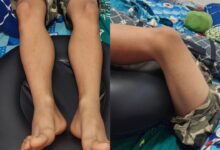 Guru hukum 800 ‘squat’, pelajar masuk hospital