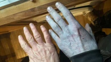 Kecoh badan lelaki bertukar biru, rupa-rupanya…