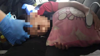Budak 6 tahun cedera mata kanan tertusuk besi kusyen kereta