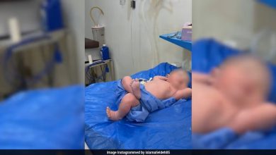 Siap silang kaki, bayi relaks selepas lahir