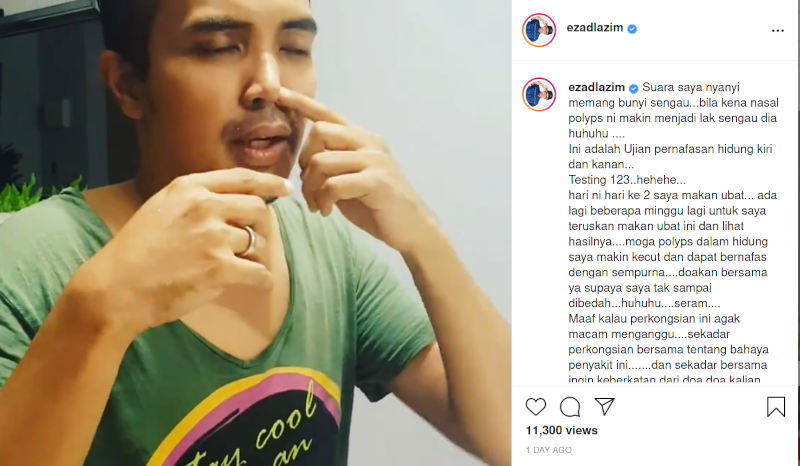 EZAD LAZIM : KETUMBUHAN NASAL POLYPS, SUARA MAKIN SENGAU