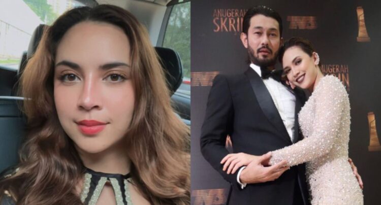 Diana Danielle Akui Alami Masalah Memori Dan Cepat Lupa