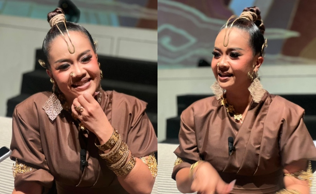 Mimifly Cedera Tangan Hingga Berdarah