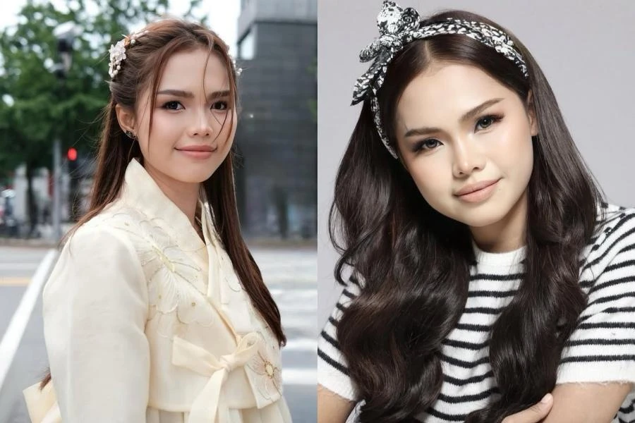 Bella Astillah Akui Bakal Pakai Braces