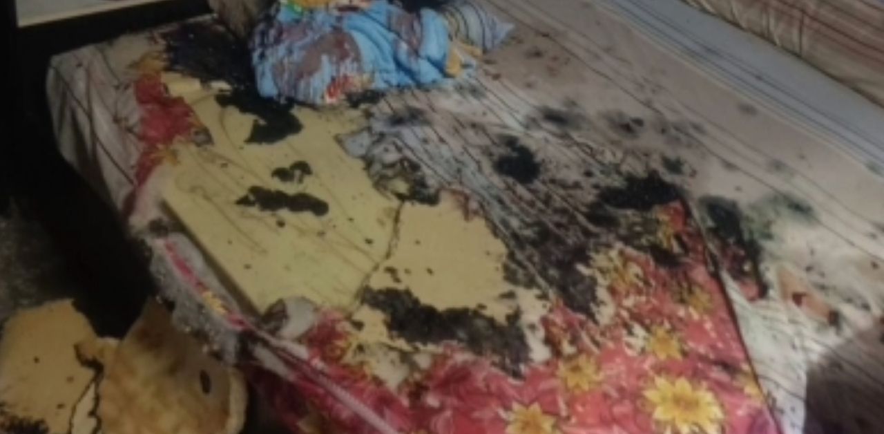 Isteri simbah asid pada suami semasa hari jadi