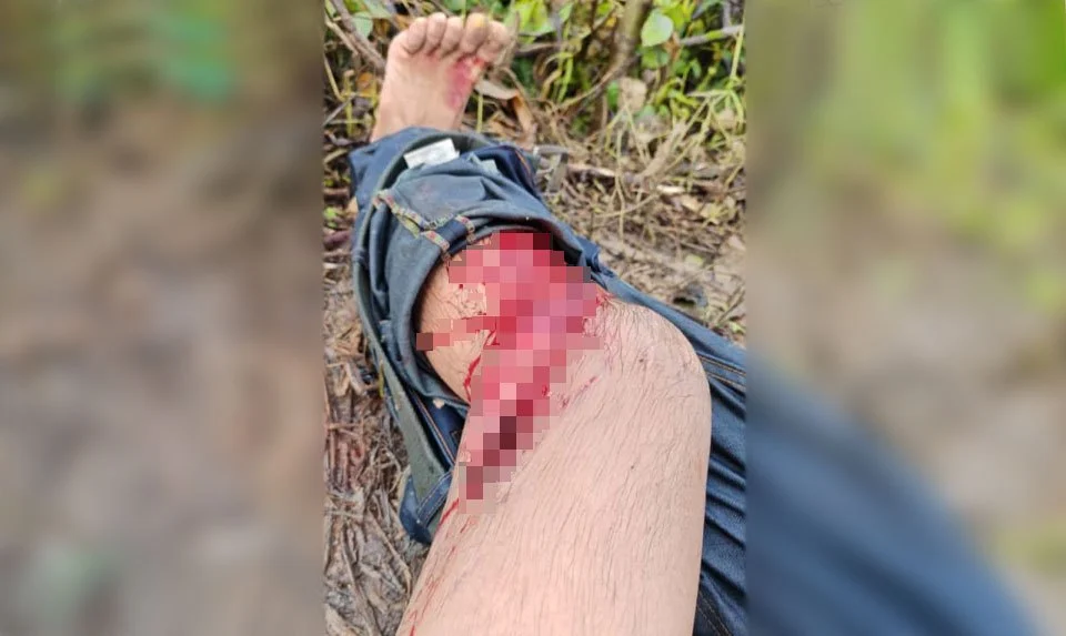 Banjir: Lelaki cedera parah dibaham buaya