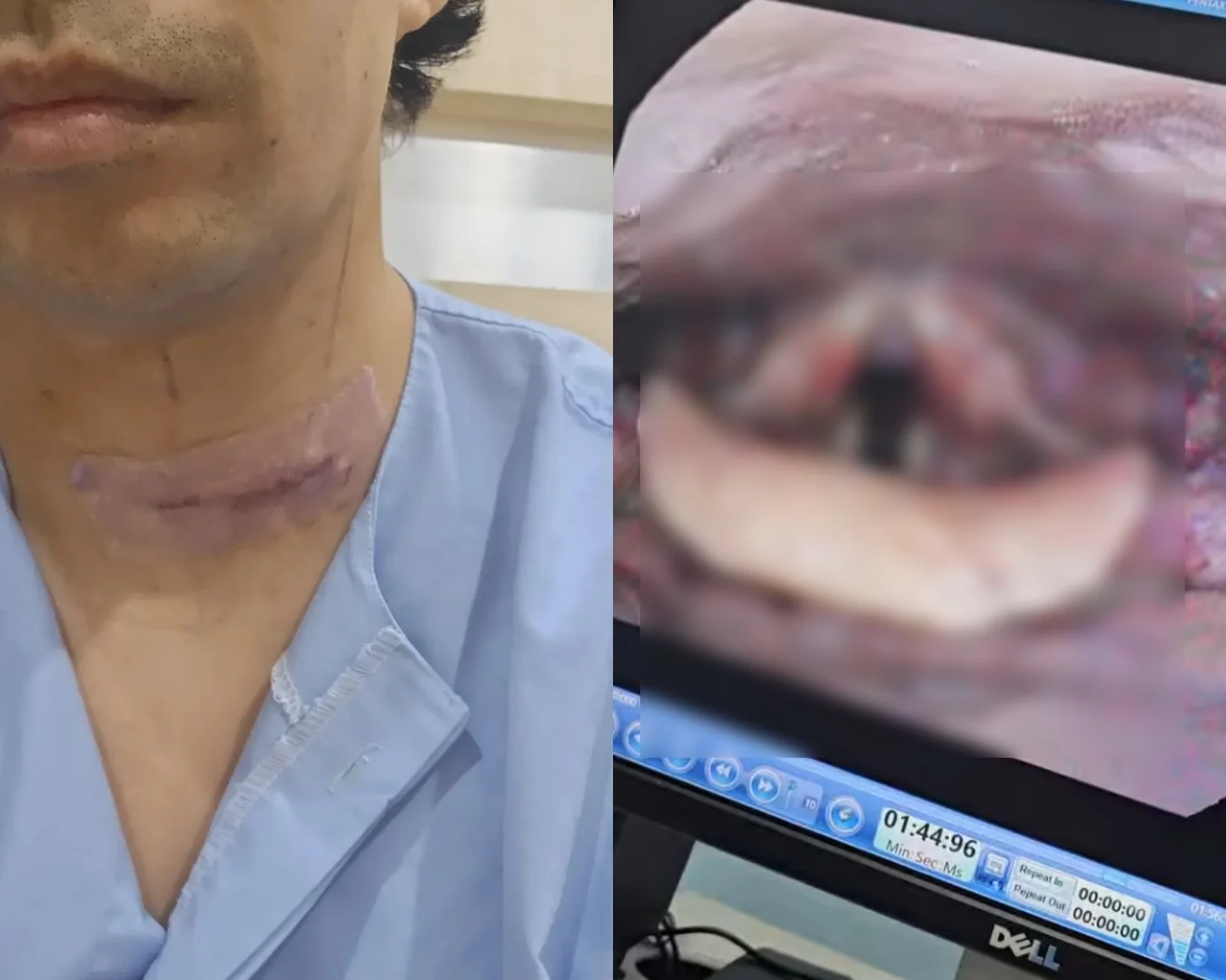 TokTi Saran Noh Salleh Berehat Seketika