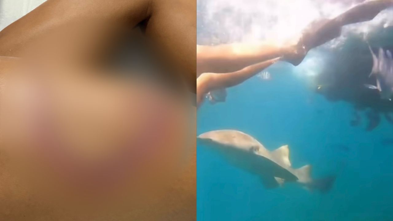 Paha wanita carik dibaham jerung